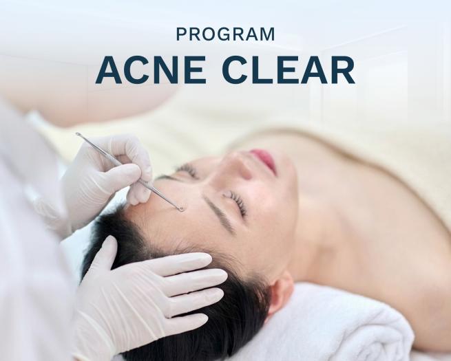 Acne Clear Treatment